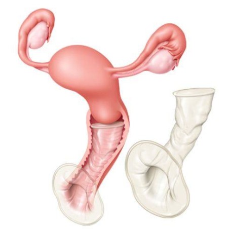 Condones Preservativo Femenino 30 Unds.