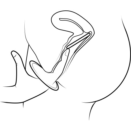 Comprar Preservativo Femenino 30 unidades | Mascondon®